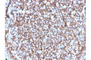 Formalin-fixed, paraffin-embedded human tonsil stained with CD11b Monospecific Mouse Monoclonal Antibody (ITGAM/3340).