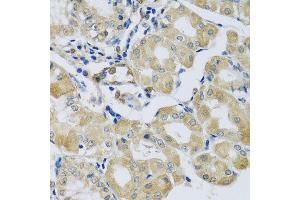 Immunohistochemistry of paraffin-embedded human stomach using SYT11 antibody.