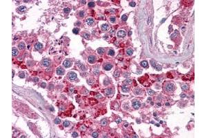 Human Testis: Formalin-Fixed, Paraffin-Embedded (FFPE) (BIRC3 anticorps)