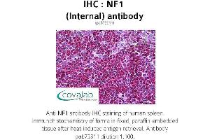 Image no. 2 for anti-Neurofibromin 1 (NF1) (Internal Region) antibody (ABIN1737327)
