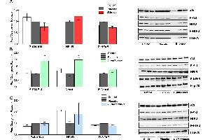 Western blot analysis of P-Akt/Akt ratio, NF-kB and P-NF-kB proteins of rats fed either placebo, (A) B. (NF-kB p65 anticorps  (AA 51-100))