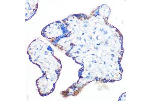 Immunohistochemistry of paraffin-embedded human placenta using Epac1/R Rabbit mAb (ABIN7269850) at dilution of 1:100 (40x lens). (RAPGEF3 anticorps)