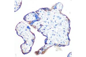 Immunohistochemistry of paraffin-embedded human placenta using Epac1/R Rabbit mAb (ABIN7269850) at dilution of 1:100 (40x lens).