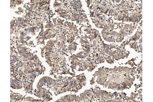 IHC analysis of TAB2 using anti-TAB2 antibody (ABIN7600244). (TAB2 anticorps  (AA 169-522))