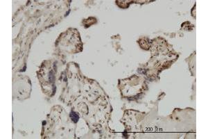 Immunoperoxidase of monoclonal antibody to ZIC4 on formalin-fixed paraffin-embedded human placenta. (ZIC4 anticorps  (AA 249-319))