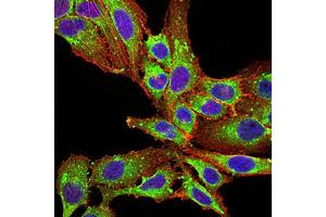 Immunocytochemistry (ICC) image for anti-Phospholipase D2 (PLD2) (AA 834-933) antibody (ABIN5881791) (Phospholipase D2 anticorps  (AA 834-933))