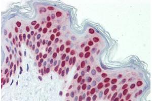 Human Skin (formalin-fixed, paraffin-embedded) stained with BXDC5 antibody ABIN462228 followed by biotinylated goat anti-rabbit IgG secondary antibody ABIN481713, alkaline phosphatase-streptavidin and chromogen.