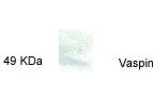Western blot analysis of Vaspin in rat visceral white adipose tissue using Anti-Vaspin (386-414) (Human) Antiserum     Rat visceral white adipose tissue homogenate on 10% SDS-PAGE gel    Rabbit Anti-Vaspin (386-414) (Human) Antiserum at 1:100