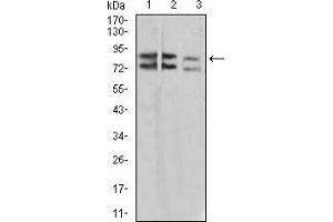 Western blot analysis using IL1RAPL1 mouse mAb against A431 (1), SK-Hep-1 (2), and HL-7702 (3) cell lysate. (IL1RAPL1 anticorps  (AA 541-694))