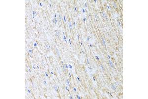 Immunohistochemistry of paraffin-embedded mouse heart using RCN2 antibody at dilution of 1:100 (x40 lens). (RCN2 anticorps)