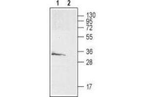 anti-Galanin Receptor 3 (GALR3) (AA 159-172), (Extracellular) antibody