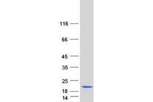Validation with Western Blot