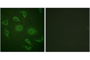 Immunofluorescence (IF) image for anti-Interferon alpha/beta Receptor 1 (IFNAR1) (AA 436-485) antibody (ABIN2888850) (IFNAR1 anticorps  (AA 436-485))