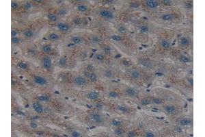 Detection of SHH in Human Liver Tissue using Polyclonal Antibody to Hedgehog Homolog, Sonic (SHH)