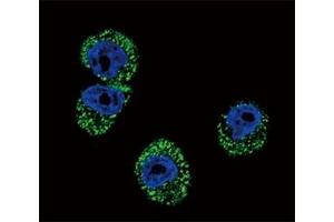 Confocal immunofluorescent analysis of CCR7 antibody with MDA-MB231 cells followed by Alexa Fluor 488-conjugated goat anti-rabbit lgG (green).