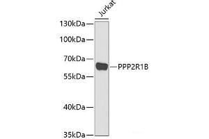 Western blot analysis of extracts of Jurkat cells using PPP2R1B Polyclonal Antibody at dilution of 1:1000. (PPP2R1B anticorps)