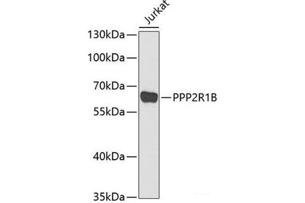 PPP2R1B anticorps