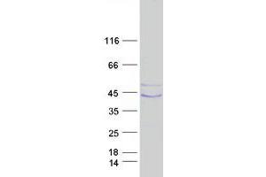 Validation with Western Blot (PLAUR Protein (Transcript Variant 1) (Myc-DYKDDDDK Tag))
