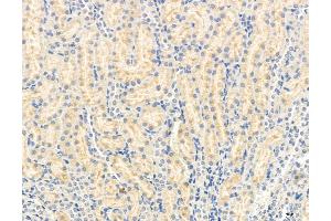 ABIN6263909 and ABIN6272972 at 1/100 staining Rat kidney tissue by IHC-P.