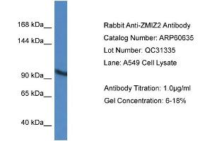 Western Blotting (WB) image for anti-Zinc Finger, MIZ-Type Containing 2 (ZMIZ2) (Middle Region) antibody (ABIN2788517) (ZMIZ2 anticorps  (Middle Region))
