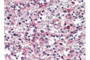 Human Spleen, Red Pulp (formalin-fixed, paraffin-embedded) stained with CTNND1at 1/15 followed by biotinylated goat anti-rabbit IgG secondary antibody, alkaline phosphatase-streptavidin and chromogen. (CTNND1 anticorps  (C-Term))