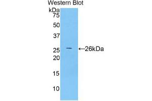 Western blot analysis of the recombinant protein. (TLR5 anticorps  (AA 693-858))