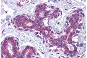 Human Breast: Formalin-Fixed, Paraffin-Embedded (FFPE) (SCAMP4 anticorps  (C-Term))