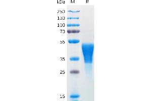 Human M-CSF Protein, His Tag on SDS-PAGE under reducing condition.