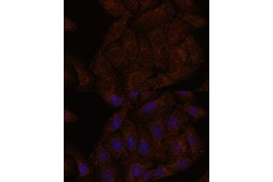 Immunofluorescence analysis of U-2 OS cells using 43716 antibody (ABIN7265350) at dilution of 1:100.