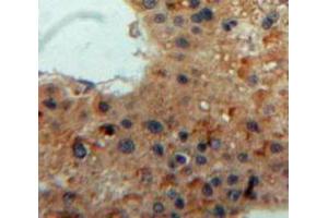 IHC-P analysis of Liver tissue, with DAB staining. (Lipase A anticorps  (AA 32-358))