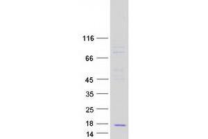 Chemokine (C-C Motif) Ligand 23 (CCL23) protein (Myc-DYKDDDDK Tag)