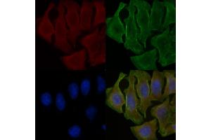 ABIN6258469 and ABIN6275385 staining Hela cells(30 min of UV treatment) by IF/ICC.