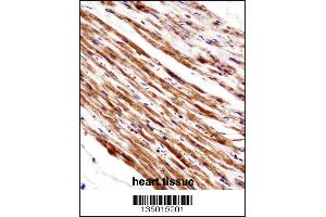 PLA2G5 Antibody immunohistochemistry analysis in formalin fixed and paraffin embedded human heart tissue followed by peroxidase conjugation of the secondary antibody and DAB staining.