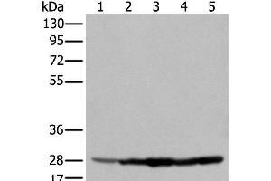 Western blot analysis of 293T cell Hela cell A549 cell using ECI1 Polyclonal Antibody at dilution of 1:350 (DCI anticorps)