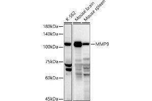 Western blot analysis of extracts of various cell lines, using MMP9 antibody (ABIN3022899, ABIN3022900, ABIN3022901, ABIN1513215 and ABIN6219286) at 1:1000 dilution. (MMP 9 anticorps  (AA 538-707))