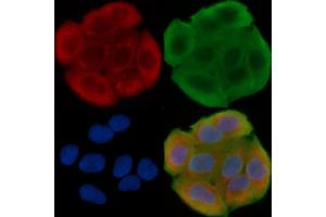ABIN6262407 and ABIN6276441 staining Hela cells(30 min of UV treatment) by IF/ICC. (GRP94 anticorps  (C-Term))
