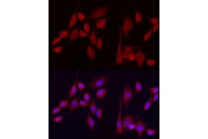 Immunofluorescence analysis of NIH/3T3 cells using EXT1 Rabbit pAb (ABIN3022736, ABIN3022737, ABIN3022738 and ABIN6219202) at dilution of 1:100 (40x lens).