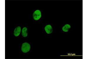 Immunofluorescence of purified MaxPab antibody to RPA2 on HeLa cell. (RPA2 anticorps  (AA 1-270))