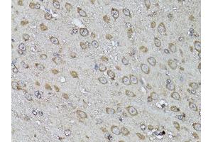 Immunohistochemistry of paraffin-embedded mouse brain using SNAI1 antibody (ABIN5998900) at dilution of 1/100 (40x lens). (SNAIL anticorps)
