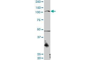 CTNNA3 MaxPab rabbit polyclonal antibody. (CTNNA3 anticorps  (AA 1-516))