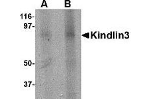 Western Blotting (WB) image for anti-Fermitin Family Member 3 (FERMT3) (C-Term) antibody (ABIN1030468)