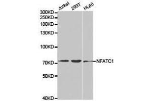 Western Blotting (WB) image for anti-Nuclear Factor of Activated T-Cells, Cytoplasmic, Calcineurin-Dependent 1 (NFATC1) antibody (ABIN1873889) (NFATC1 anticorps)