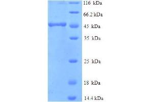SDS-PAGE (SDS) image for neonatal Fc Receptor (FcRn) (AA 24-297), (Extracellular) protein (His-SUMO Tag) (ABIN5711682)