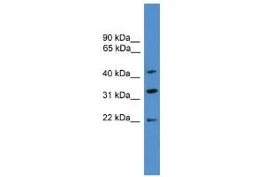 WB Suggested Anti-ARFIP1  Antibody Titration: 0. (ARFIP1 anticorps  (C-Term))