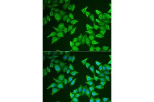 Immunofluorescence analysis of HeLa cells using ALAS2 antibody (ABIN5973907). (ALAS2 anticorps)