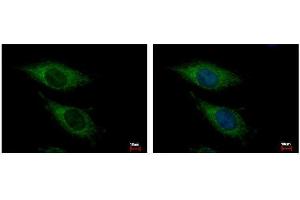 ICC/IF Image OGDH antibody [C2C3], C-term detects OGDH protein at Mitochondria by immunofluorescent analysis.