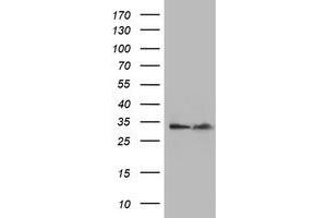 Western Blotting (WB) image for anti-Exosome Component 7 (EXOSC7) antibody (ABIN1498143) (EXOSC7 anticorps)