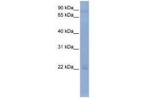 WB Suggested Anti-OAS2 Antibody Titration:  0. (OAS2 anticorps  (Middle Region))
