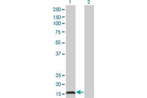 Western Blot analysis of IFNA2 expression in transfected 293T cell line by IFNA2 monoclonal antibody (M38), clone 2D10. (IFNA2 anticorps  (AA 24-188))