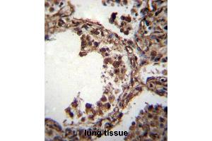 TUBA1C Antibody (C-term) immunohistochemistry analysis in formalin fixed and paraffin embedded human lung tissue followed by peroxidase conjugation of the secondary antibody and DAB staining. (TUBA1C anticorps  (C-Term))